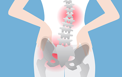 坐骨神経痛や椎間板ヘルニアの場合